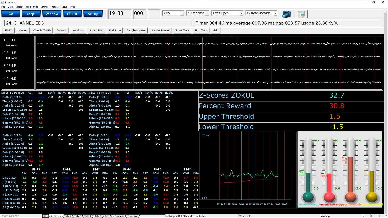 qEEG-Pro Z-Score-Training, bis 4 Kanäle