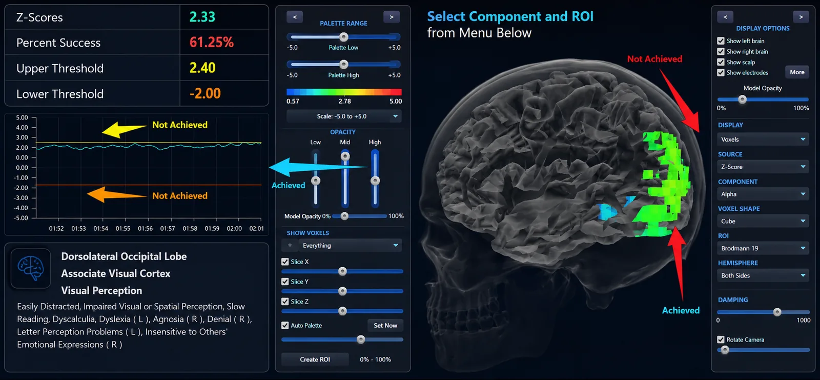 qEEG-Pro Surface- und sLORETA-Z-Score-Training im Set