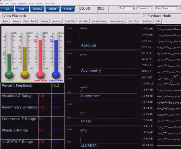 IFEN Pro-Z Protokoll für Discovery