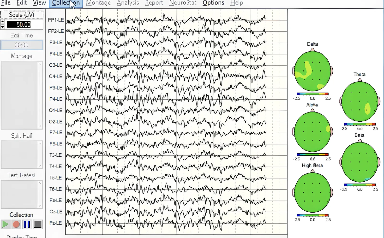 NeuroGuide | Professionelle QEEG-Analyse & Brain Mapping