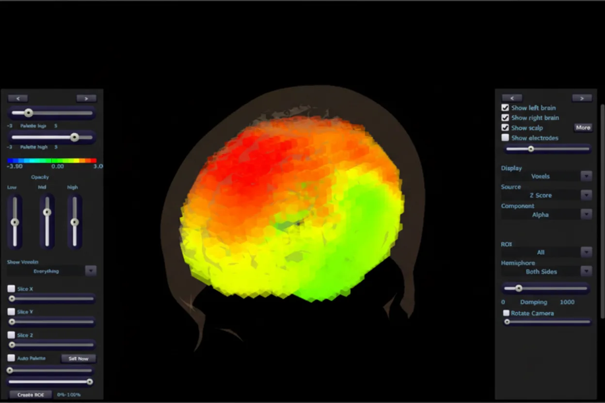 BrainAvatar 4.0 LLP Connectivity Suite
